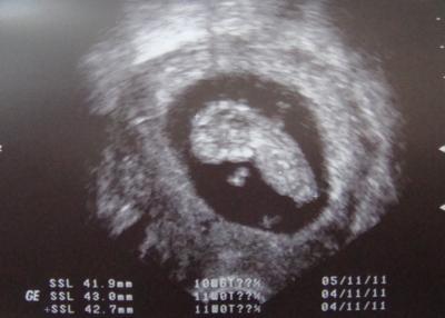 Bild zu HAPPY!!!! - Forum für November - Mamis