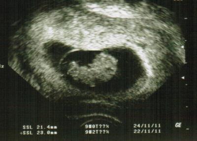 Bild zu US-Bild hinterherschieb!!! - Forum für November - Mamis