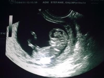 Bild zu 11 SSW und Bild für euch :o) - Forum für November - Mamis