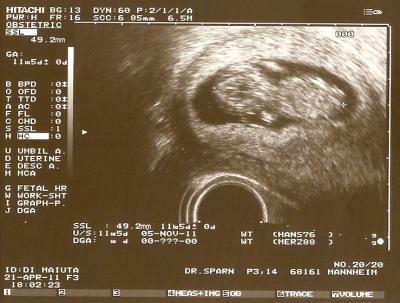Bild zu Krümel-Foto - Forum für November - Mamis