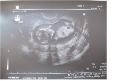 Bild zu Neues Foto vom Krümel und neuer FA :-) (sehr lang!!!) - Forum für November - Mamis