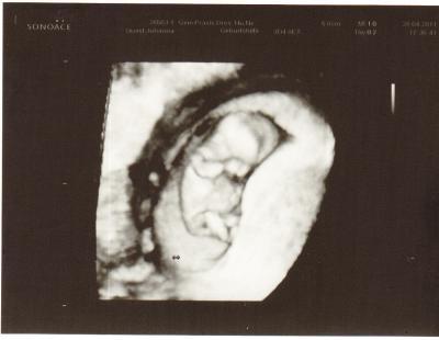 Bild zu Bild 3D und akuter Anfall von Schwangerschaftdemenz!!!!!!!!!!! - Forum für November - Mamis