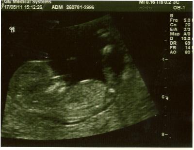 Bild zu ENDLICH - NF Scanning und damit auch mein erstes Foto - Forum für November - Mamis