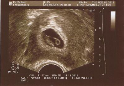 Bild zu Fotos - Forum für November - Mamis