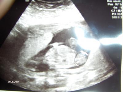 Bild zu Outing und ick will die Welt umarmen!!! - Forum für November - Mamis