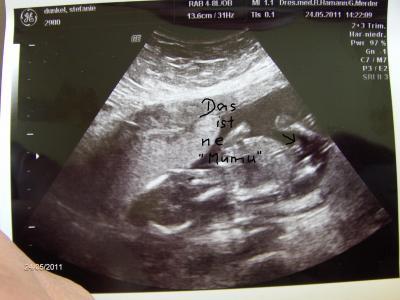 Bild zu Soooooooo, hier mal zwei bessere Bilchen hoffe ick!!! - Forum für November - Mamis