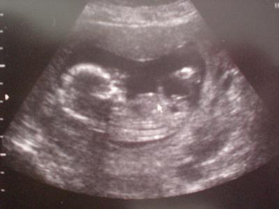 Bild zu Foto von meinem Bauchzwerg! - Forum für November - Mamis