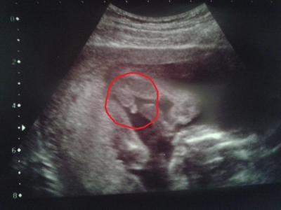 Bild zu Bild von mein Kleinen - Forum für November - Mamis