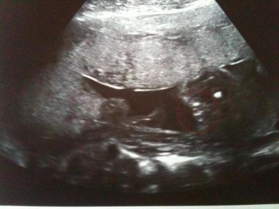 Bild zu Outing + US - Forum für November - Mamis