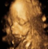 Bild zu FD + Bild und entlich Outing! - Forum für November - Mamis