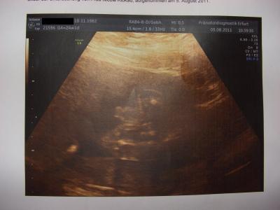 Bild zu Was denkt ihr? Rätselrunde - Forum für November - Mamis