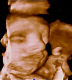 Bild zu Babyfoto - Forum für November - Mamis