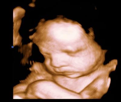 Bild zu JA - ich hab's getan: 3 D-Fotos!! - Forum für November - Mamis