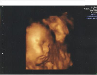 Bild zu 3d Ultraschall - Forum für November - Mamis