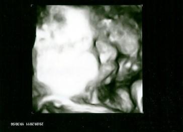 Bild zu Juchu wenigstens ein 3D Bild hab ich - Forum für November - Mamis