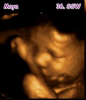 Bild zu Endlich ein 3D-Bild... :-) - Forum für November - Mamis