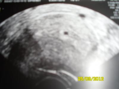 Bild zu Mein erstes baby ;-) - Forum für November - Mamis