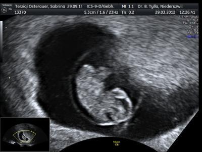 Bild zu zurück vom us!! :)))) - Forum für November - Mamis