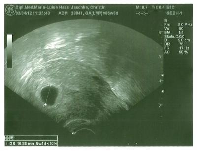 Bild zu Arzttermin - Forum für November - Mamis