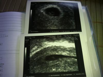 Bild zu so die neuen bilder - Forum für November - Mamis