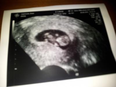 Bild zu FA-Bericht - Forum für November - Mamis