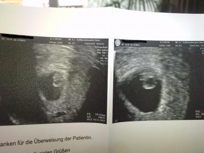 Bild zu Hallo ich bin zum ersten mal schwanger :-) - Forum für November - Mamis