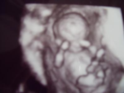 Bild zu darf ich mal junior vorstellen - Forum für November - Mamis