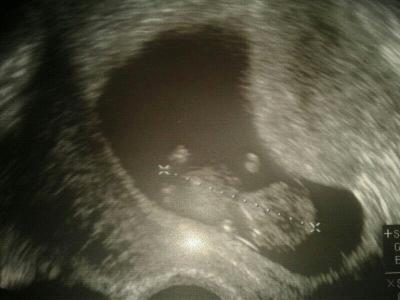 Bild zu Mein Krümmelchen :) - Forum für November - Mamis