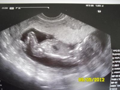 Bild zu mein großes baby ;-) - Forum für November - Mamis