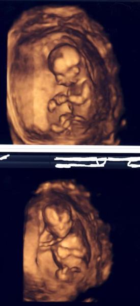 Bild zu NFM-Bericht + Bildchen - Forum für November - Mamis