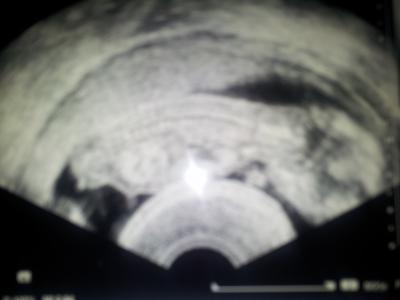 Bild zu Gewichtsabnahme und ein Foto :) - Forum für November - Mamis