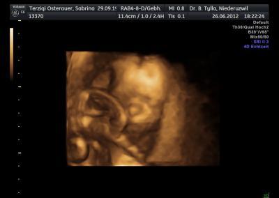 Bild zu auch mal wieder FA bericht ! - Forum für November - Mamis