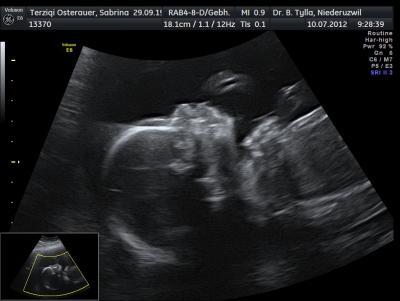 Bild zu zurück vom glukosetest - Forum für November - Mamis