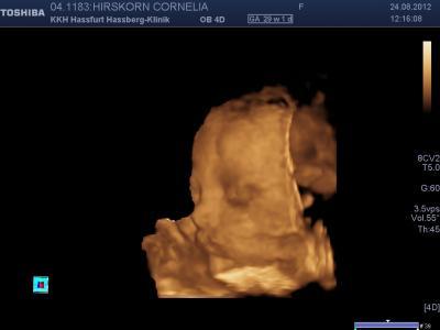 Bild zu Enttäuscht und verwirrt von 3D Termin!!!Vorsicht lang - Forum für November - Mamis