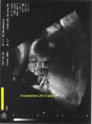 Bild zu Gestern VU - Forum für November - Mamis