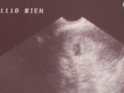 Bild zu arzttermin - Forum für November - Mamis