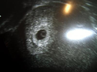 Bild zu Zurück vom FA - Grinse wie ein Honigkuchenpferd :) - Forum für November - Mamis