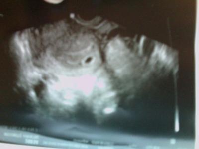 Bild zu mein pünktchen... - Forum für November - Mamis