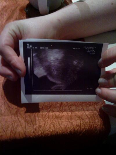 Bild zu Bericht vom heutigen Arzttermin. - Forum für November - Mamis