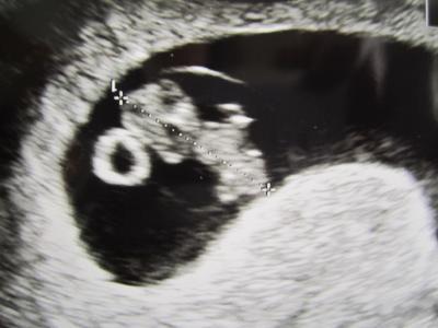 Bild zu Zurück vom 2. FA-Besuch - Forum für November - Mamis