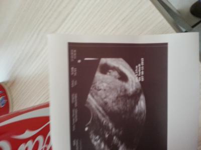 Bild zu auch zurück - Forum für November - Mamis