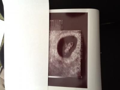 Bild zu Auch zurück vom FA... :) - Forum für November - Mamis
