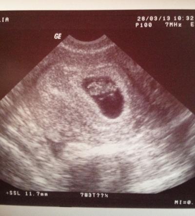 Bild zu Zurück vom FA :-) - Forum für November - Mamis