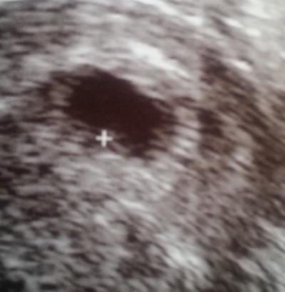 Bild zu Darf doch noch bei euch weiter mit fahren ;-) - Forum für November - Mamis