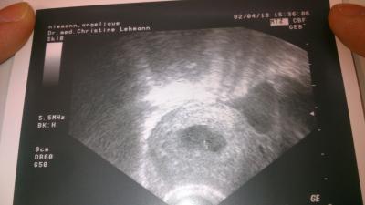 Bild zu heute beim gyn - Forum für November - Mamis