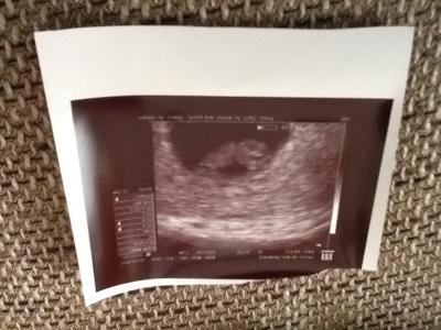 Bild zu Auf einmal Panik... - Forum für November - Mamis