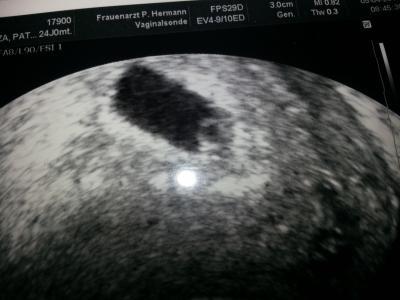 Bild zu Zurück vom Fa - Forum für November - Mamis