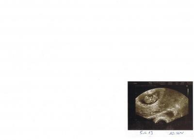 Bild zu Hier das versprochene Bild! - Forum für November - Mamis