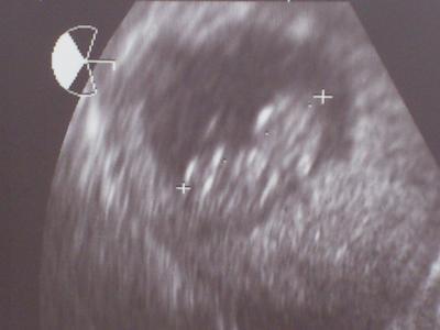 Bild zu wieder zurück + bildchen - Forum für November - Mamis