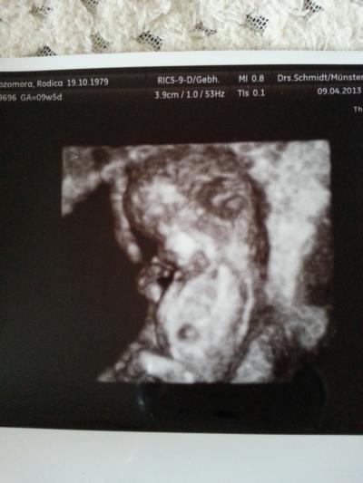Bild zu FA Termin 9+5 und siehe mal da..... ein riesen Gummibärchen. - Forum für November - Mamis